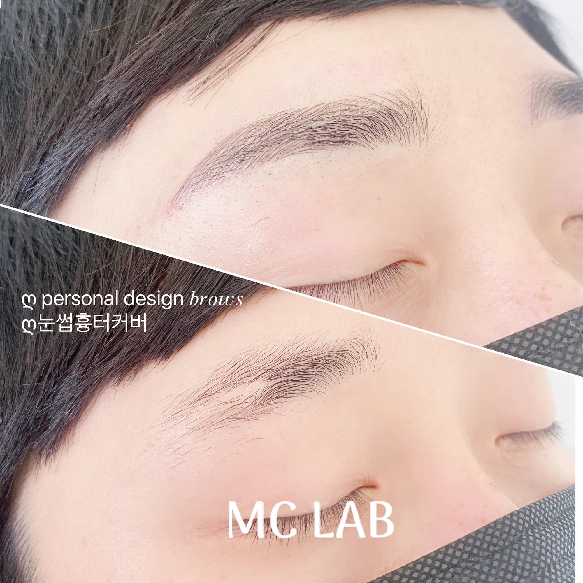 눈썹흉터커버 눈썹문신